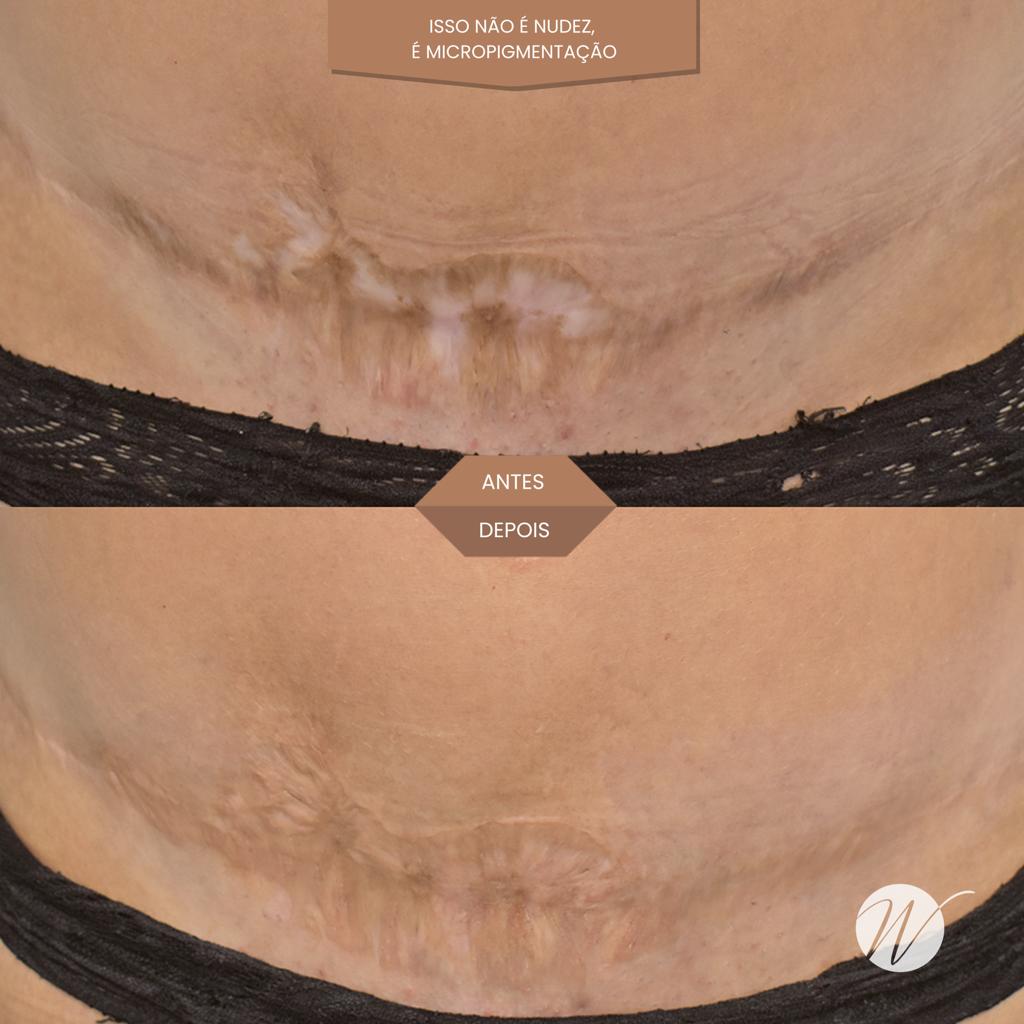 Wendy Brasil antes e depois