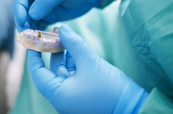 Implante dentário